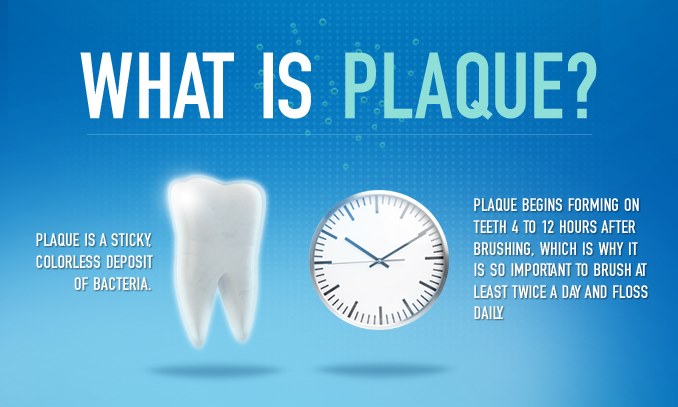 Tooth plaque and tartar and the way to remove them Dr