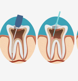 Endodontics