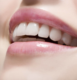 Cosmetic Dental Procedures