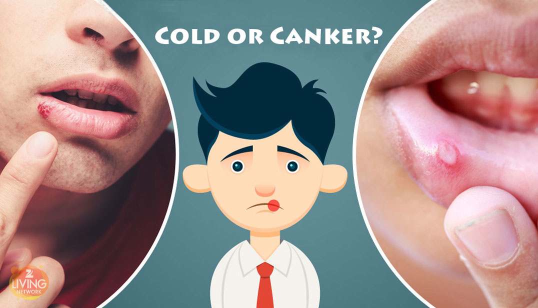 how much does valtrex shorten a cold sore