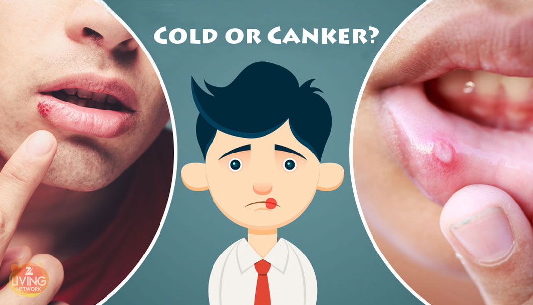 home remedy for cut inside mouth