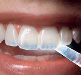 Tooth Enamel & Dental care