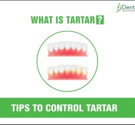 How to Control Tartar the Basic tips